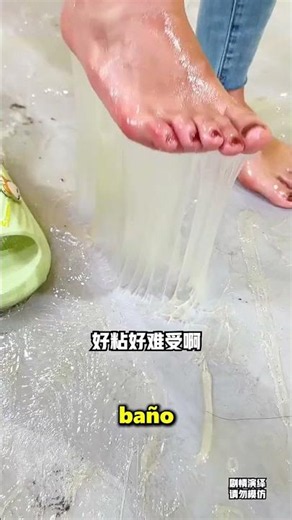 This Girl Got Stuck In Mouse Glue 😱