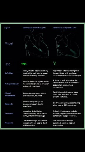 🔴Understanding Ventricular Fibrillation (VF) vs. Ventricular Tachycardia (VT) Ahmed Mohsen Ahmed Al-Askary #Cardiology #HeartHealth #Arrhythmia #VentricularFibrillation #VentricularTachycardia #VF #VT #ECG #MedicalEducation #Cardiologists #HeartCare #EmergencyMedicine #HealthcareProfessionals #HeartRhythm | Abdallah Othman