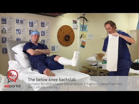 Below knee backslab