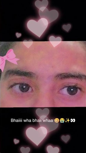 eyess 👀✨😭🩷🍒 #edit