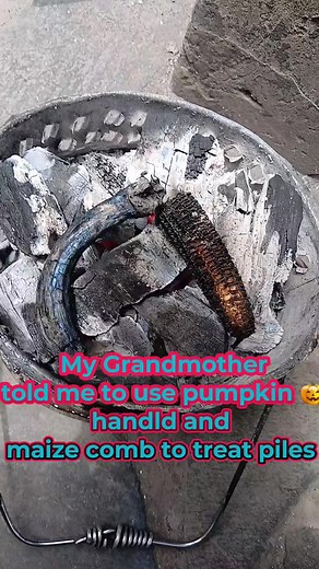 How to treat piles completely #piles #health #relatablecontent @charity Kamwela phiri