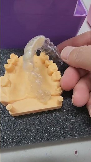 Essix retainer with teeth