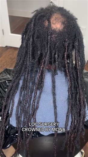 Loc surgery w/ my 16 inch 100% human hair permanent loc extensions 🔥 @crownedbymona #cbmlocs 👑💕 | crownedbymona