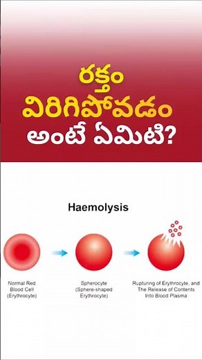 What is Hemolysis? When to suspect?