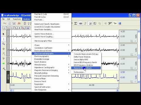 EEG - EOG Artifact Removal
