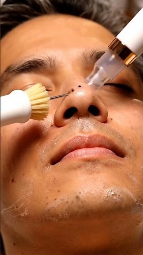 ASMR Full Face Deep Cleansing🎧 | Blackhead Removal & Glowing Skin Facial Treatment