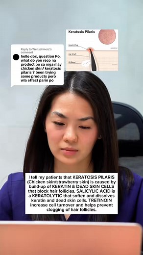 42K views · 81 reactions | Alternate-Night Routine Night 1: 1) Cleanse 2) Apply a salicylic acid lotion or serum (1–2%). 3) Moisturize afterward. Night 2: 1) Cleanse gently. 2) Apply a pea-sized amount of tretinoin (start with 0.025% or 0.05%) on affected areas. 3) Follow with moisturizer. Consult with a Board-certified Dermatologist for a routine suitable to you. | Dr. Kash Dermatology | Facebook