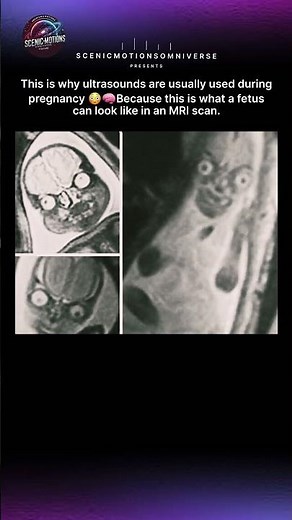 Scientists Can See Human Development Like Never Before 😳🧠