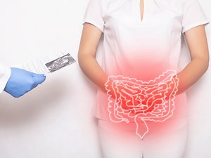 Duodenal Switch vs. SADI: A Weight Loss Surgery Guide