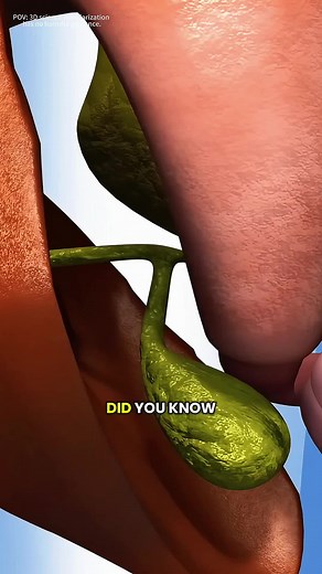 Gallbladder Removal Surgery Explained with 3D Animation