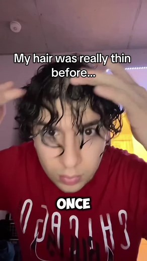 Now I just gotta fix the back of my head @StrandAiApp #hair #curls #balding #fyp #curlyhair #routine