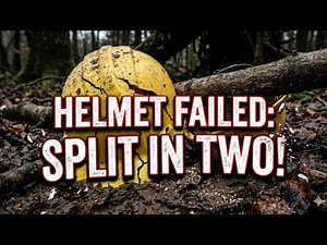 "I Should Be Dead: Surviving The 'Widowmaker' & Machine Failure"