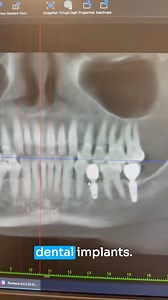 159K views · 1.2K reactions | She said: “I’m not saying it causes...