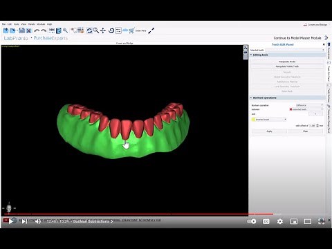 BlueSkyPlan 4.12: Copy Denture. Create a teeth file and base file for printing