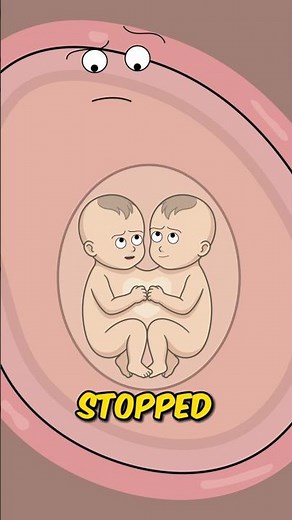 How Do CONJOINED TWINS Form? (The Science Explained) 👶👶 #shorts #viral