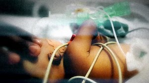 Six children dead, 12 sickened in adenovirus outbreak at New Jersey rehab facility