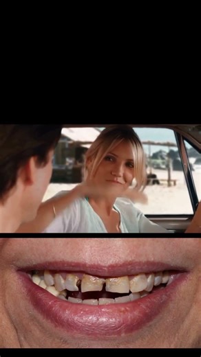 Before & After: The Ultimate Smile Transformation! ✨ #Dentistry