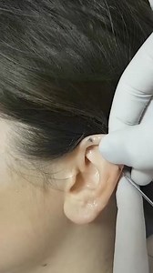 12K views · 107 reactions | #earlobepiercing #piercing #piercingcare #piercinglovers #septumpiercing | piercing.world | Facebook