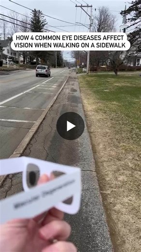 🔵 Vision Simulation of how various eye diseases (glaucoma, macular degeneration, cataract or diabetic retinopathy) can affect a persons vision while walking. | Mohammed Alharbi , OD