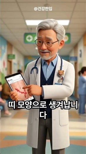 If you miss the golden time for shingles, it will be a big problem.