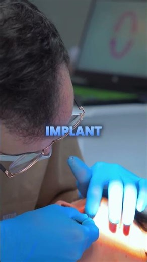 🦷 Direct-to-implant sounds simple but comes with trade-offs.