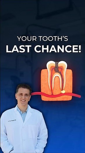 Apicoectomy vs Root Canal: Which Is The Better Option? | Apicoectomy Procedure