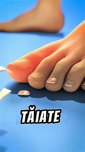 How to cut your nails correctly