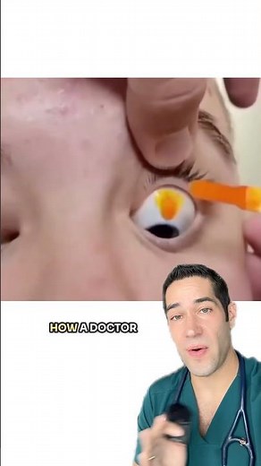 What’s in his eye?!
