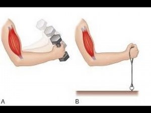 Muscular System Contraction of Whole Muscle
