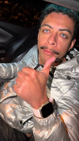 Zoio vai voltar… #foryou #viral | everson