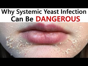 Signs of Systemic Yeast Infection