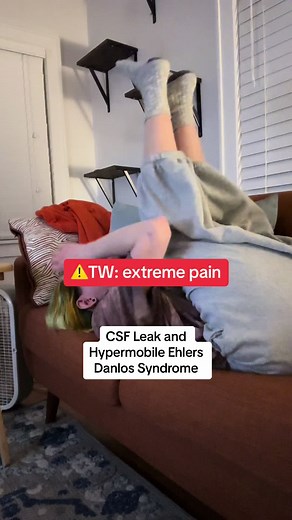 Understanding CSF Leak and Hypermobile Ehlers-Danlos Syndrome