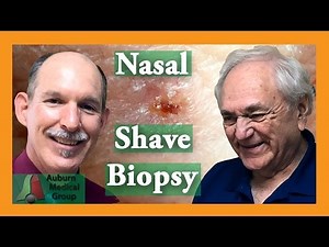 Nose Shave Biopsy | Auburn Medical Group