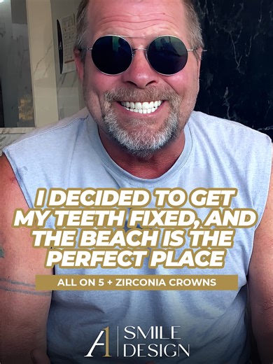 When you realize a completely renewed smile is actually possible… and without paying impossible prices. ✨🦷 This patient came to Playa del Carmen looking for a real alternative and left with a result that exceeded every expectation: All-on-5 dental implants zirconia crowns, built to last, look natural, and bring confidence back. If you’re researching dental implants in Mexico, All-on-5 dental implants, or full mouth restorations, this case will show you why so many patients choose A1 Smile Desig