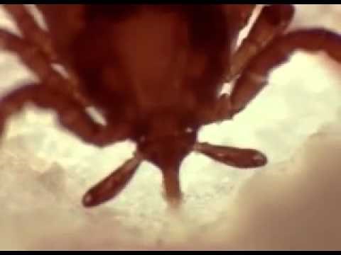 Tick's bite