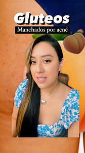 ✨Elimina manchas en glúteos y cuerpo 👌🏼 Tener manchas es normal, nada de que asustarse pero también puedes cuidar tu cuerpo para reducir ese problema Por ser un area que aveces mantenemos descuidada las manchas se pueden volver crónicas al darle cuidado a tus glúteos vamos a conseguir tener una piel mas sana y sin manchas. @babariaelsalvador | Coloretes