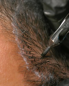 Is your hairline receding? 🤔 Well why not try out this microblading procedure for instant results! ✨ | Beauty Studio