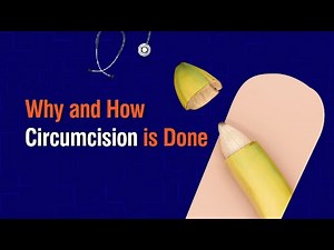 Why and How Circumcision Is Done | Dr. P.V.G.S. Prasad