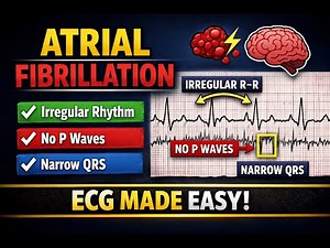 Atrial Fibrillation ECG Explained Step by Step | Easy AF ECG Interpretation
