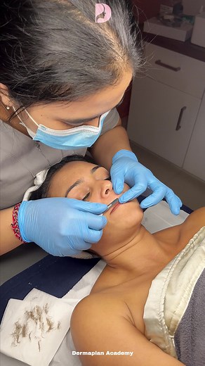 Transform Your Skin with Dermaplaning Facial at Derma Plan