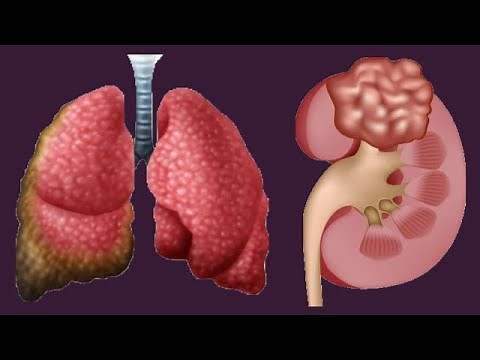 Low And High Hematocrit Levels: Causes And Symptoms