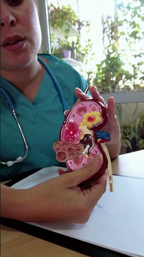¿Cómo funciona mi riñón? Estructura y filtración de la sangre?