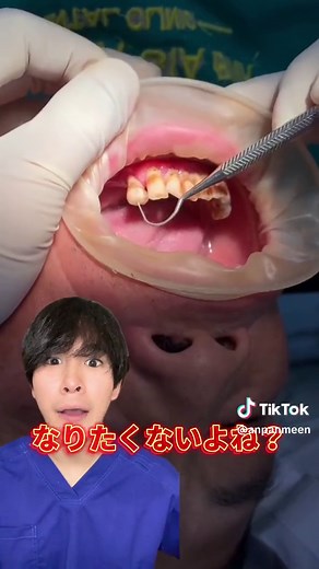 歯周病の進行と治療について