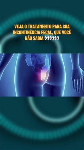 VEJA O TRATAMENTO PARA SUA INCONTINÊNCIA FECAL, QUE VOCÊ NÃO SABIA 👀👀👀