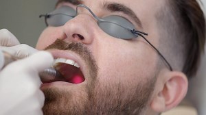 Snoring Laser Treatment using Fotona Laser | Clinique Chloe