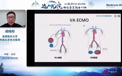 【侯晓彤】ECMO概论及生理 达MO院 心内科VA-ECMO理论与实践培训班