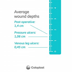 Let's talk about wound depth in post-operative wounds, venous leg ulcers and pressure ulcers. Post-operative wounds are on average the deepest at 1.4 cm, while venous leg ulcers typically have shallower depths of approximately 0.45 cm. Pressure ulcers place themselves in the middle with an average depth of 1.06 cm. It is important to fill the gap between the wound bed and the dressing to avoid pooling of wound exudate, leakage onto the periwound skin, maceration and infection. Order your "Mind T