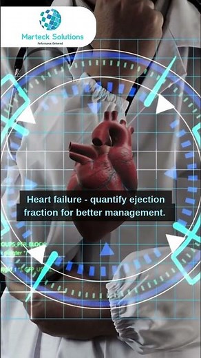 AI-Powered 2D Echo Annotation: Transforming Cardiac Diagnostics