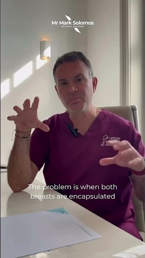 What Is Capsular Contracture? | Signs Your Breast Implant Has Hardened