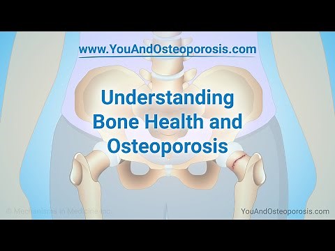 Understanding Bone Health and Osteoporosis